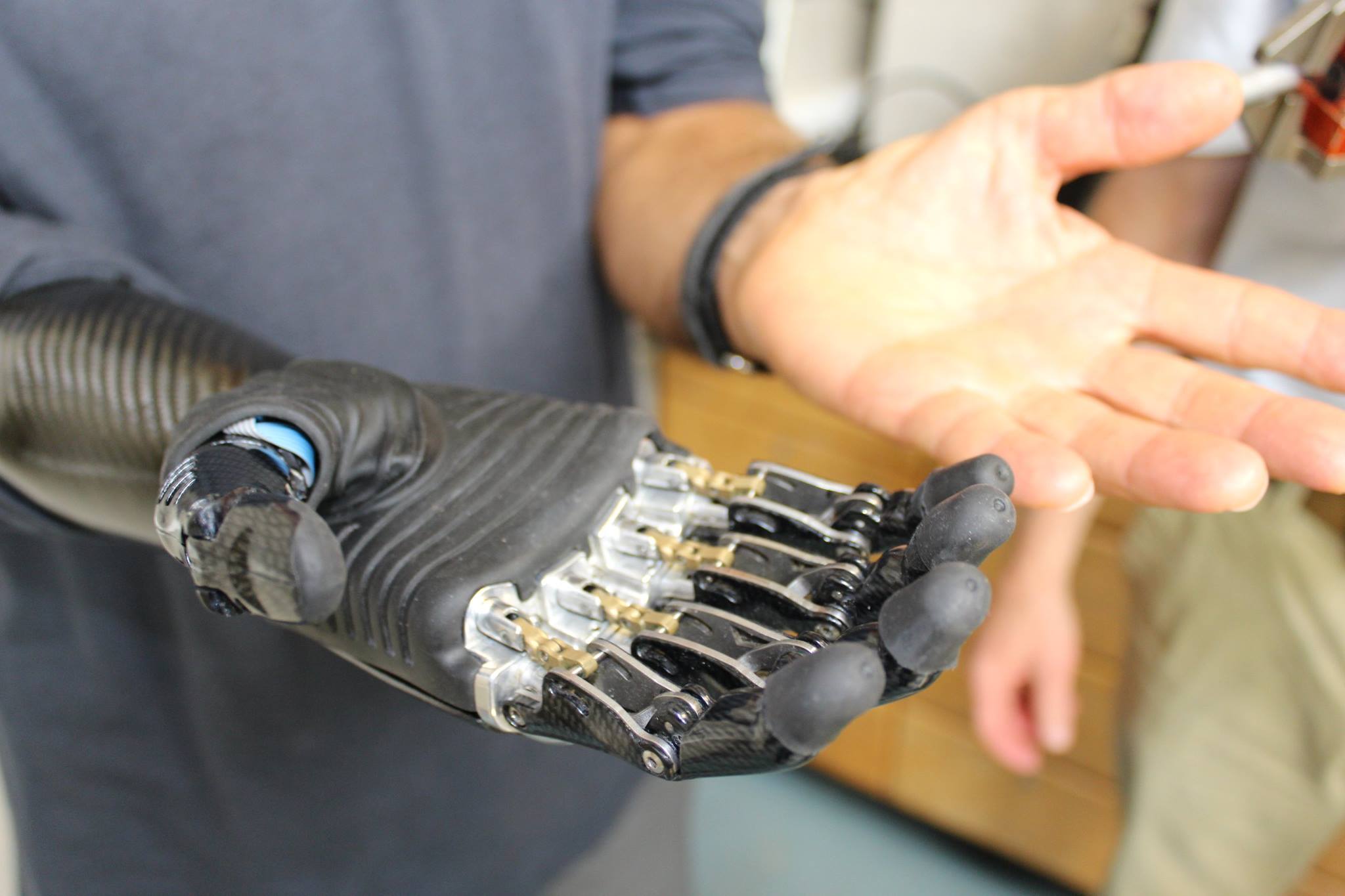 Twee opengewouwen handen; één organisch, de ander bionisch