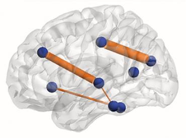 Geïllustreerde verbindingen in een brein